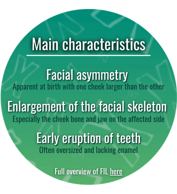 Main features of Facial Infiltrating Lipomatosis